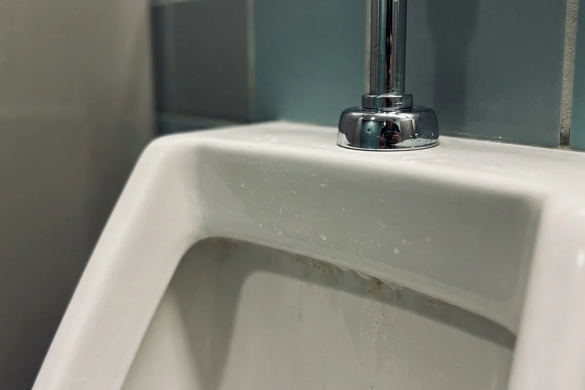 Paruresis: Warum du auf öffentlichen Toiletten plötzlich nicht mehr pinkeln kannst